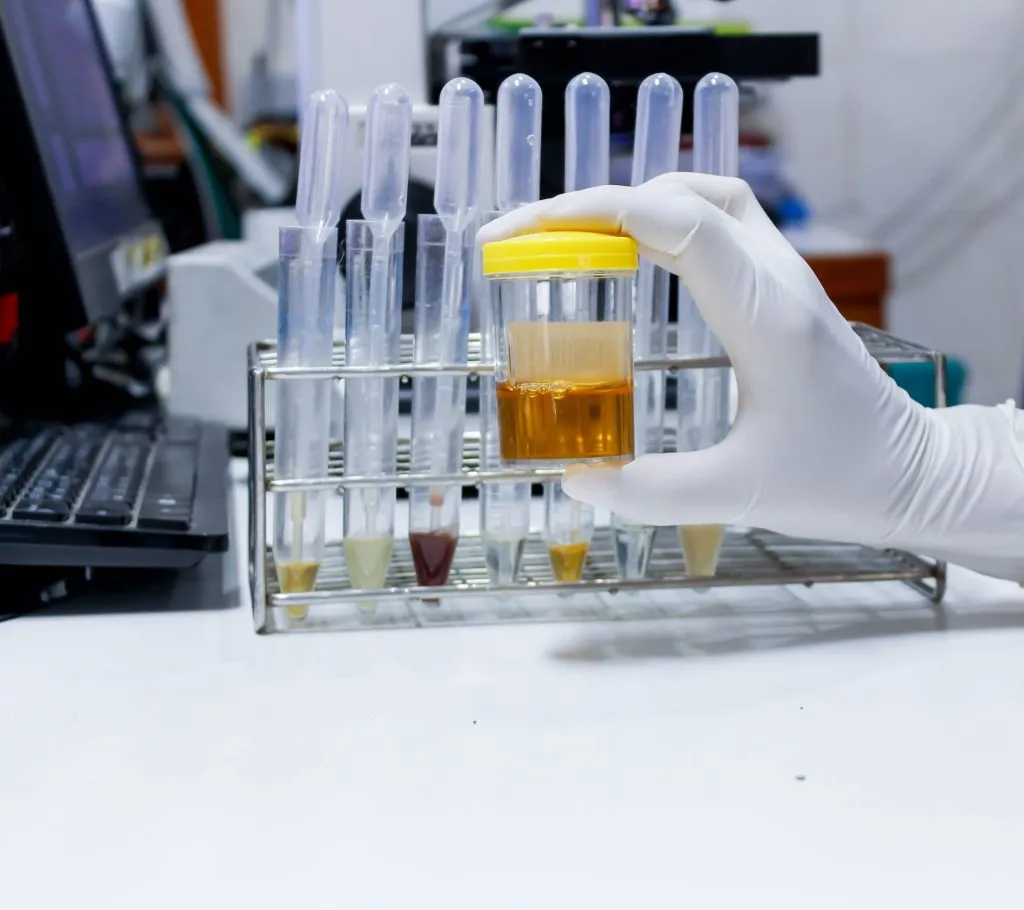 Analiza apa Timisoara